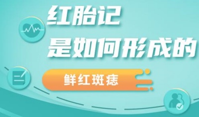 胎记是怎么引起的？