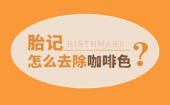 「公开榜」广州胎记医院前十名【重点十大排名】